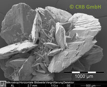 Piedras renales de oxalato de calcio | © CRB Analysis Service GmbH