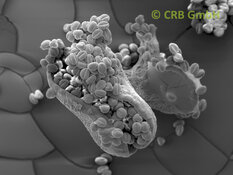 Cápsula de semillas rotas de Euphorbia leuconeura | © CRB Analysis Service GmbH