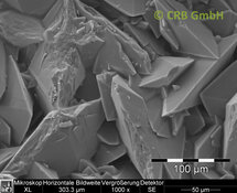 Piedras renales de oxalato de calcio | © CRB Analysis Service GmbH